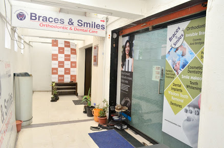 Braces & Smiles Multispeciality DentalCare-Root canals,Invisalign,Braces,Implants